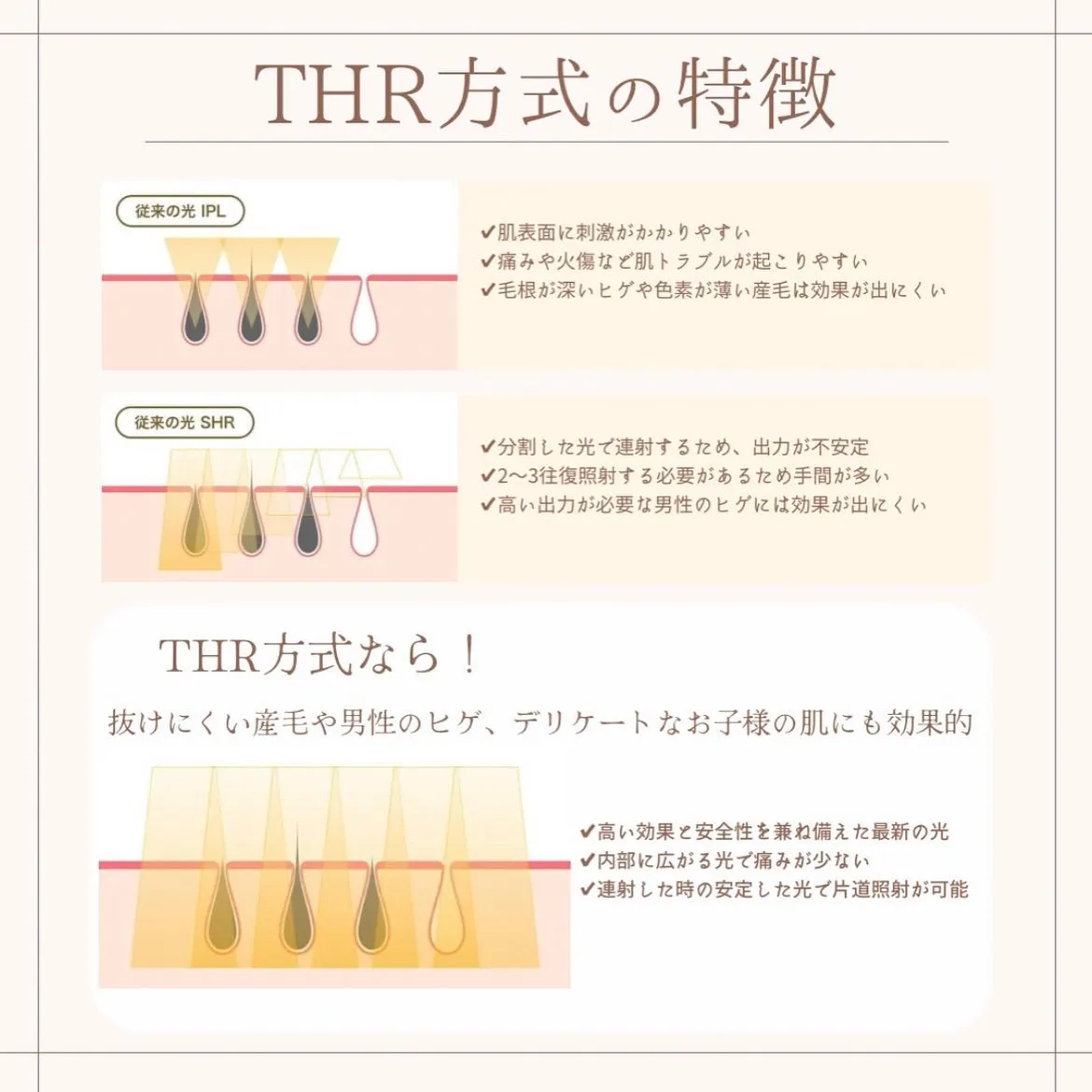 美容脱毛の良いとこ取りをしたTHR脱毛を使用しています！