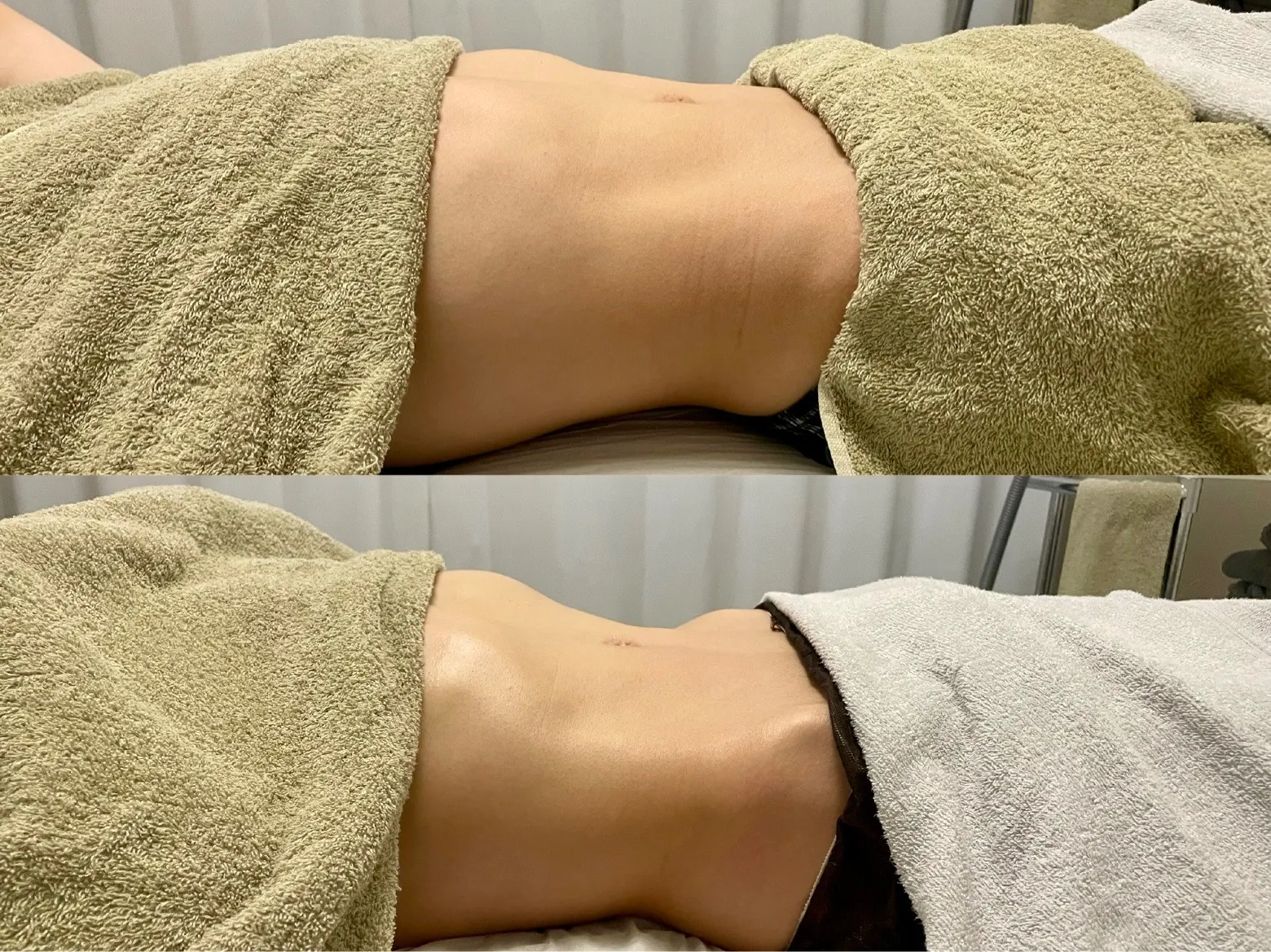 腸もみを活用した便秘解消と名古屋駅周辺で健康美を目指す方法