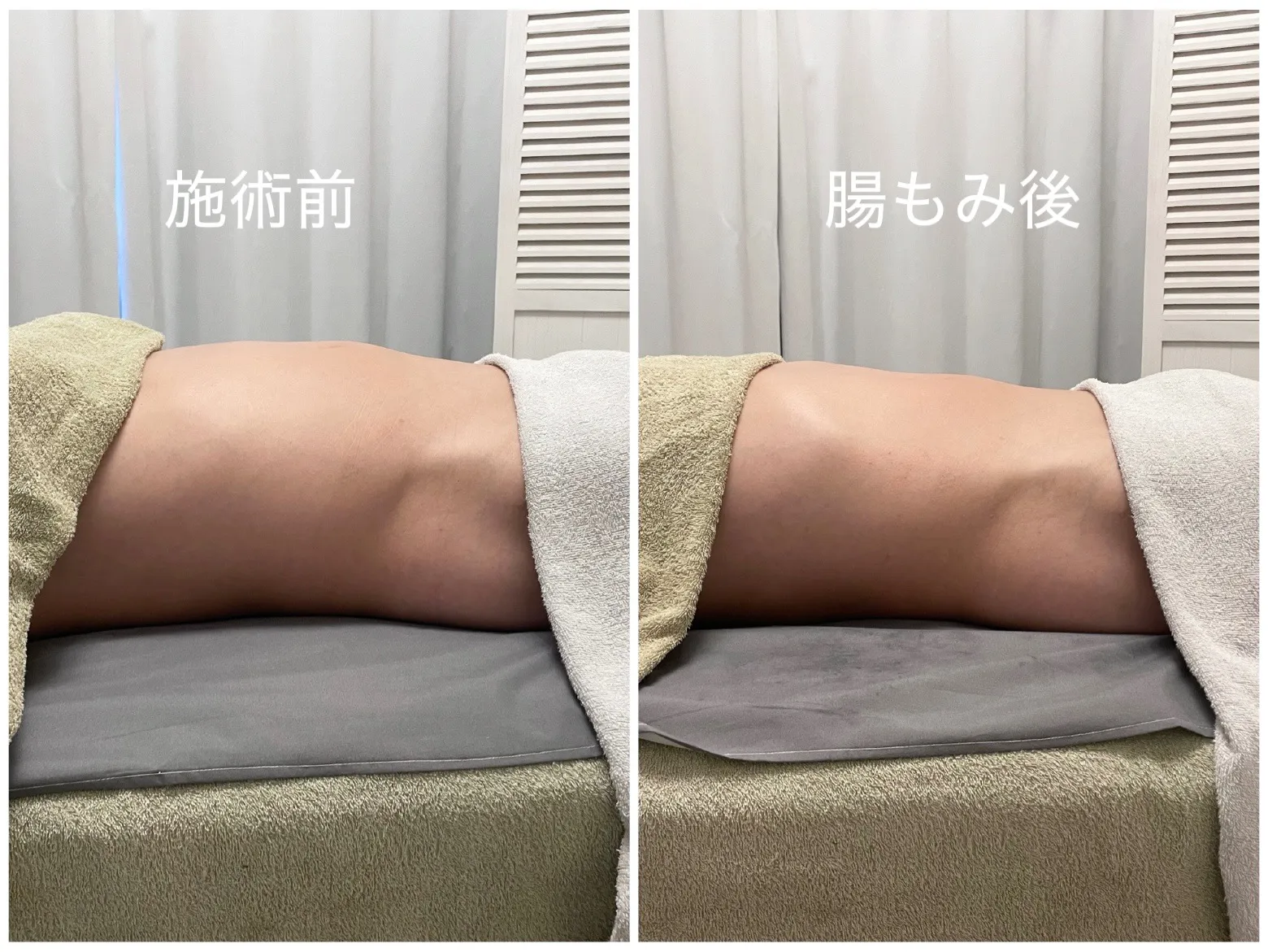 腸もみで腹部スッキリ名古屋駅近で理想の体質を目指す秘訣