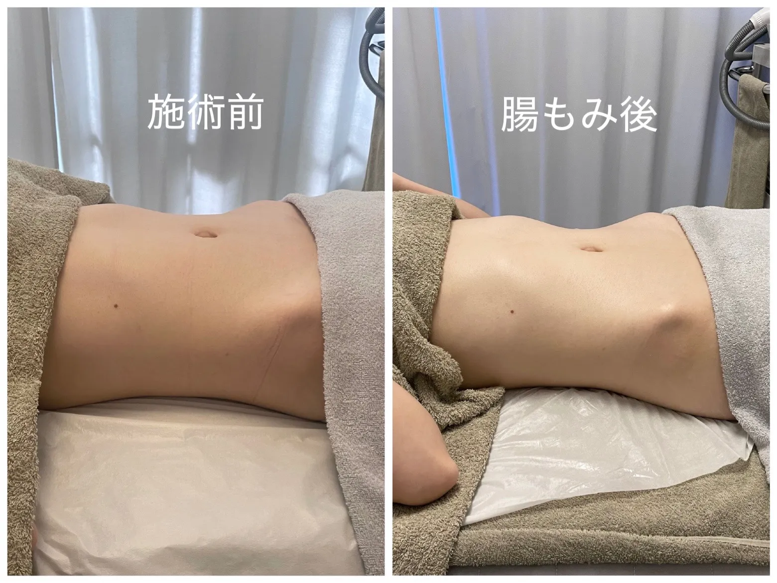 腸もみが名古屋駅で人気の理由と効果を実感できる魅力を解説